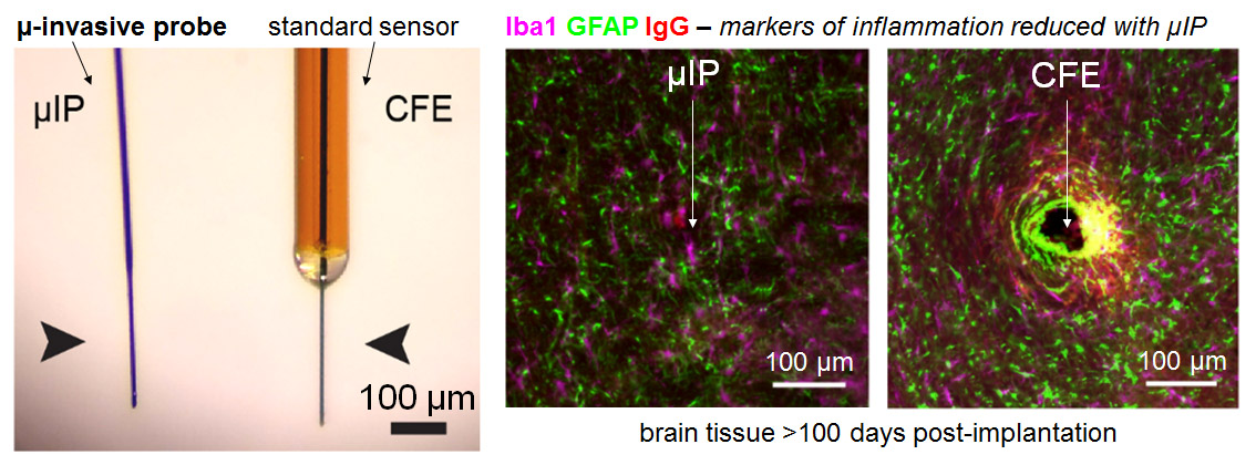 reduced inflammation around µIP